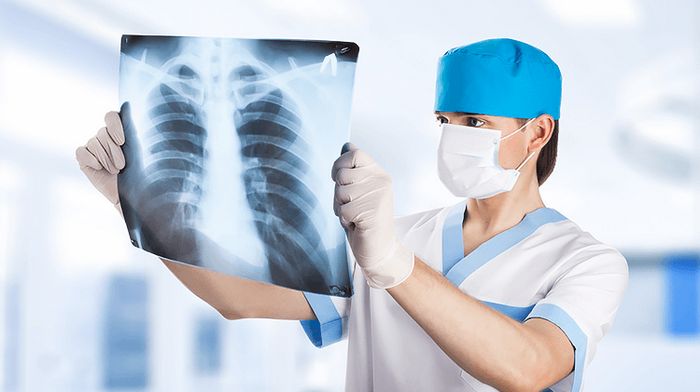 Какие бывают виды рентгенов