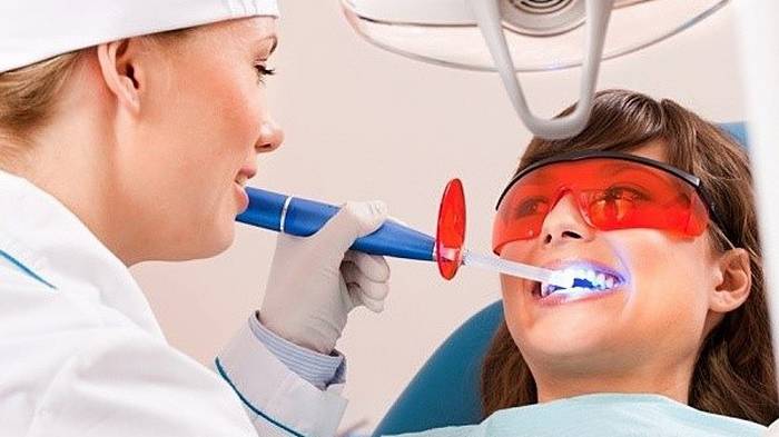 Отбеливание зубов: особенности процедуры