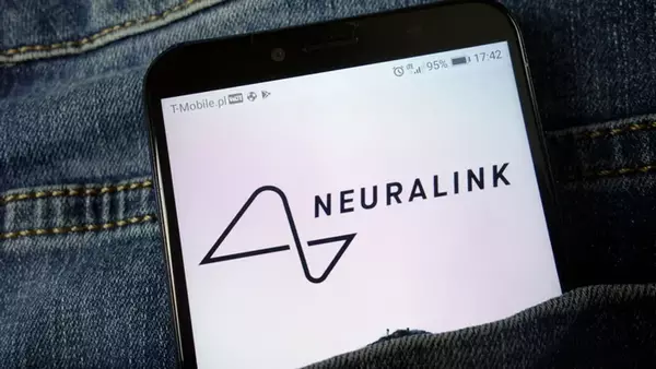 Чип Neuralink начал отходить от мозга первого пациента