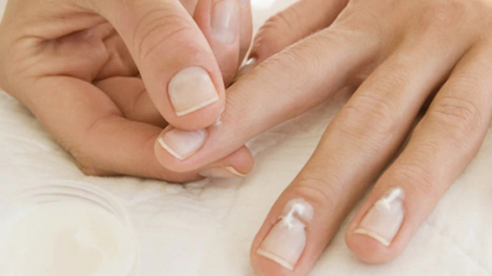 грибок ногтей