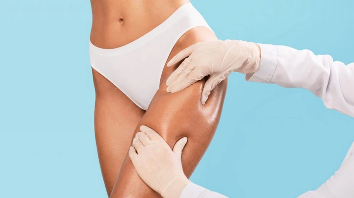 липосакция бедер