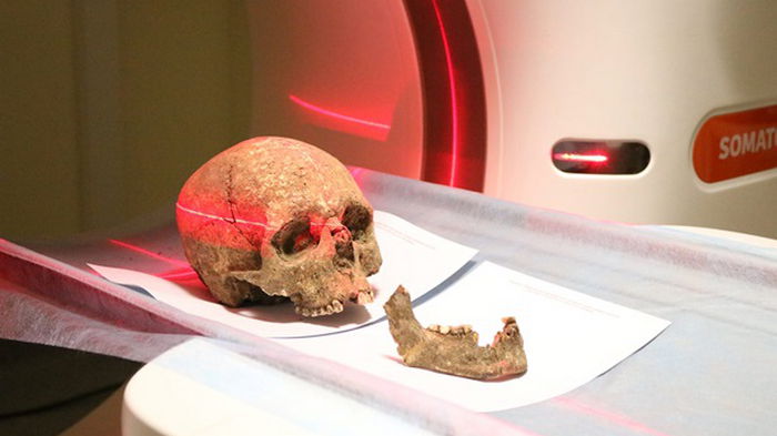 В Тернополе изучают череп возрастом три тысячи лет (видео)