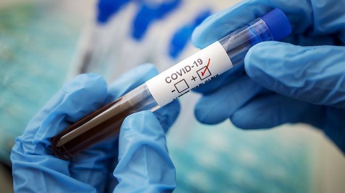 В Германии за сутки зафиксировали рекорд по заражениям коронавирусом